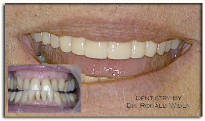 Cosmetic_dentistry_photo