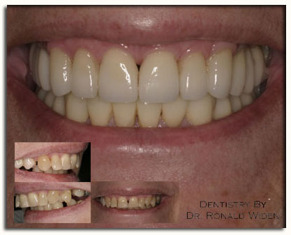 Cosmetic_dentistry_photo
