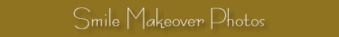 Smile Makeover Photos